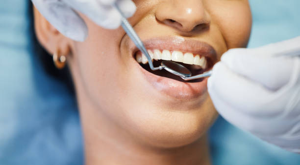 Best Emergency Treatment for Dental Infections or Abscesses in Stepping Stone, CO