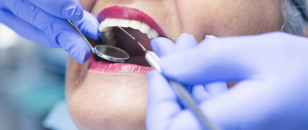 Best Cosmetic Emergency Dentistry in Stepping Stone, CO